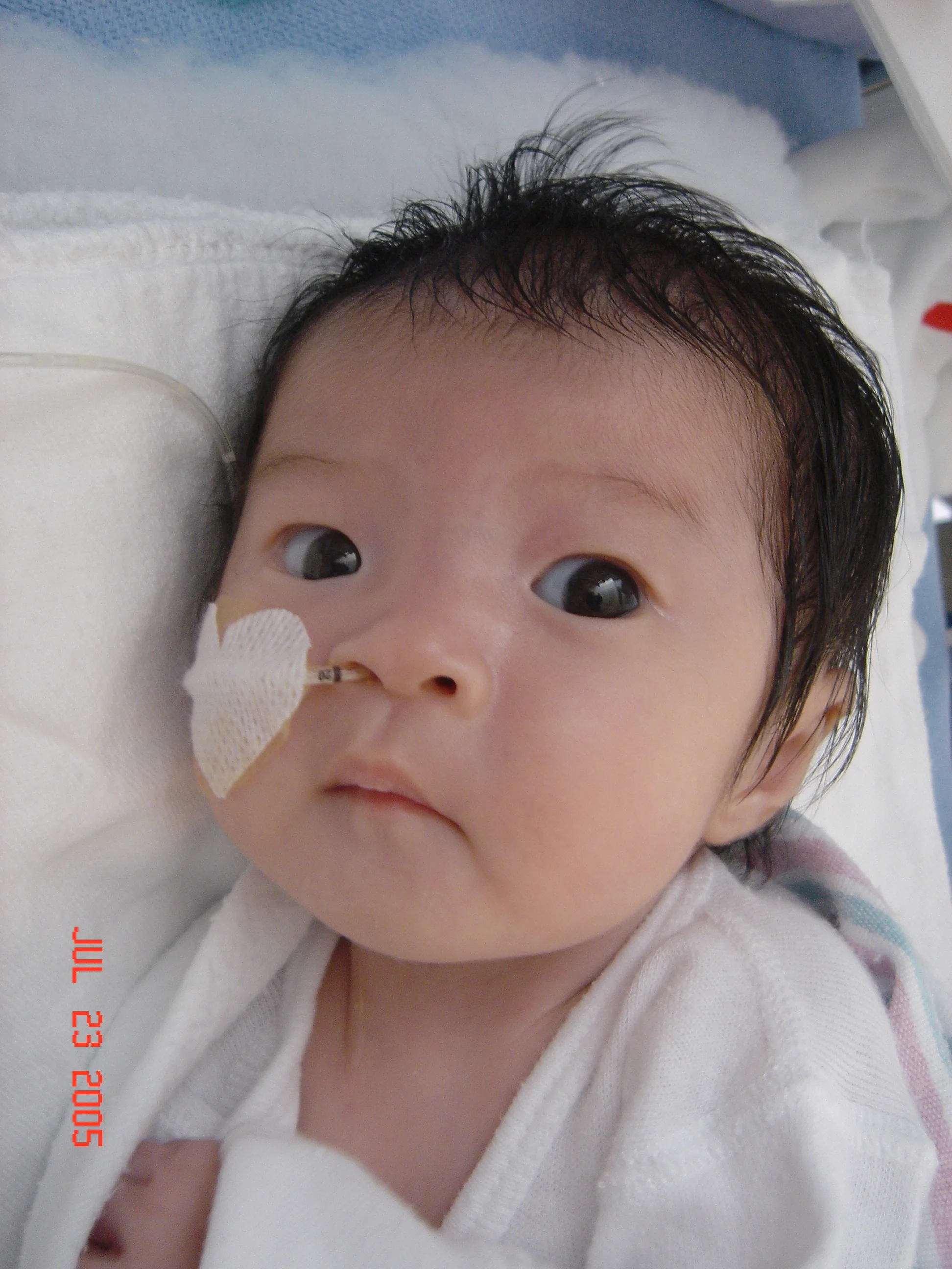 Thanks to the extraordinary care provided by the doctors and nurses in the NICU, Harumi was breathing completely on her own at 3 weeks of age.