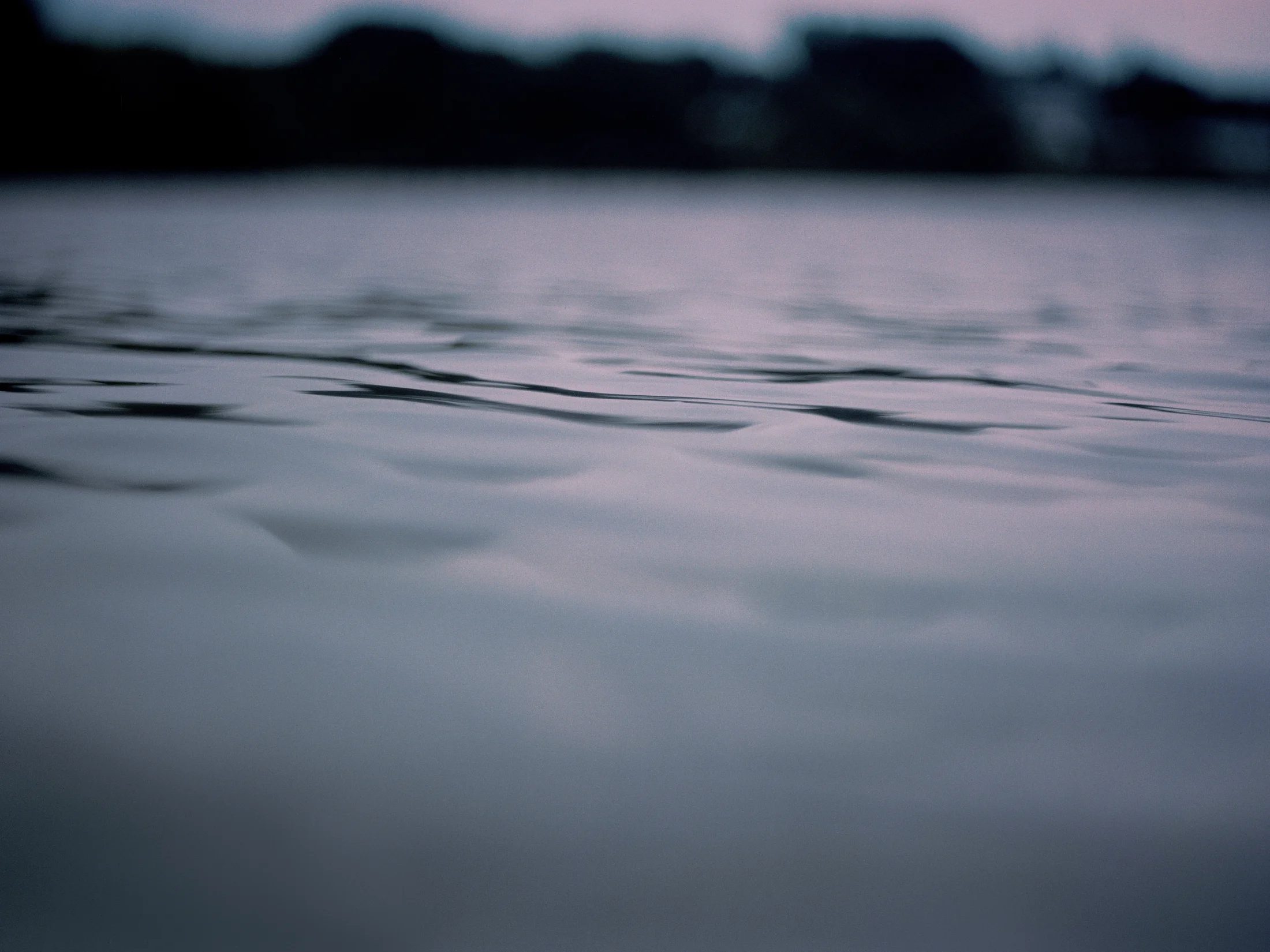 meniscus_color_09 1.jpg