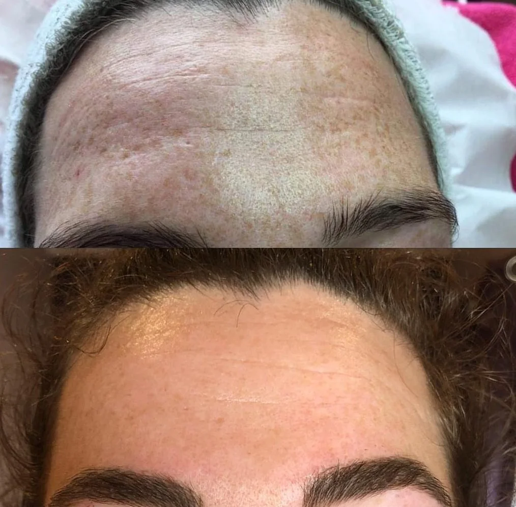 3 sessions brightening.jpg