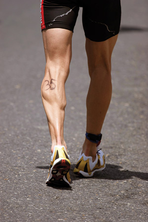 Tendinitis, Tendinosis and Tendinopathy - what's the difference?