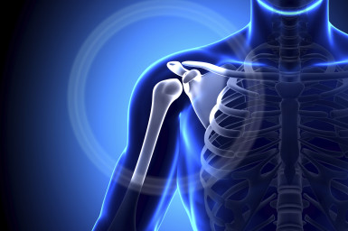 What is 'Shoulder Impingement'?