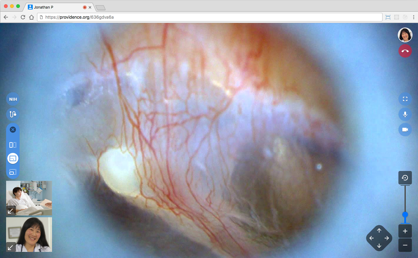 Example of switching to the handheld JedMed video tools.