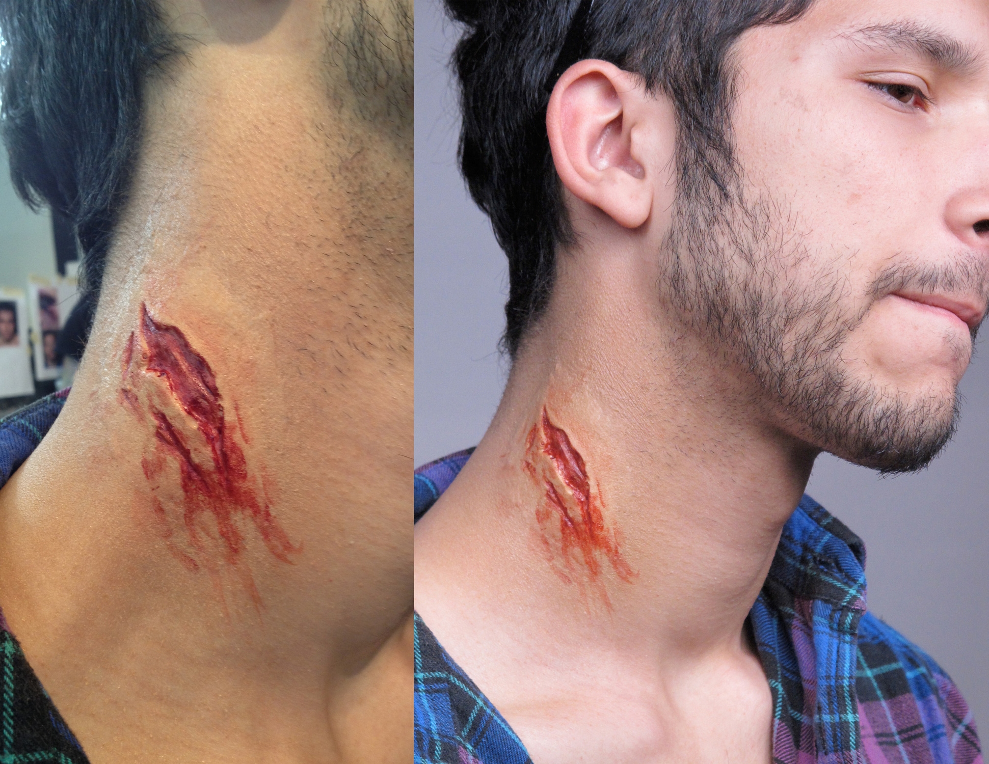Gelatin neck wound