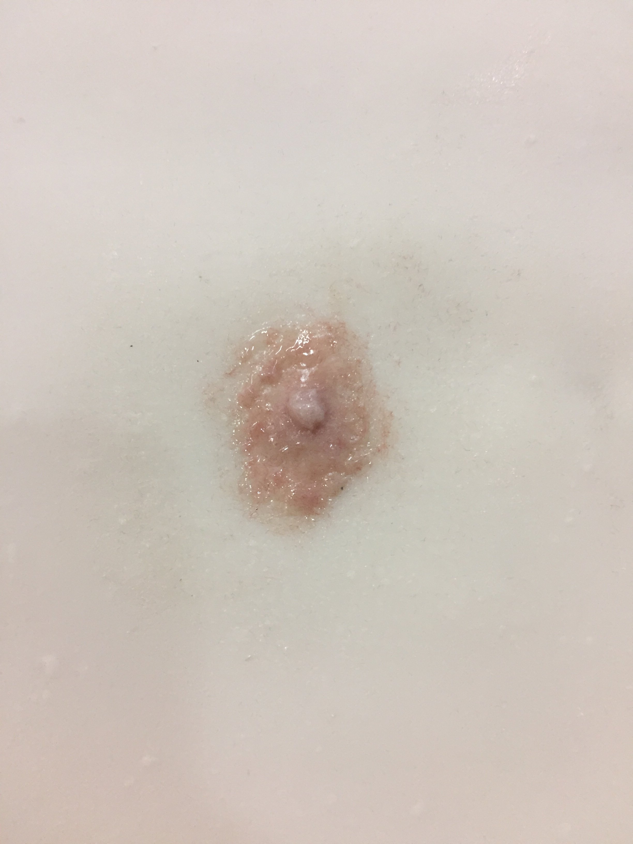 Close-up of fabricated nipple 