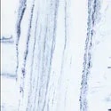 Rhapsody Blue/White