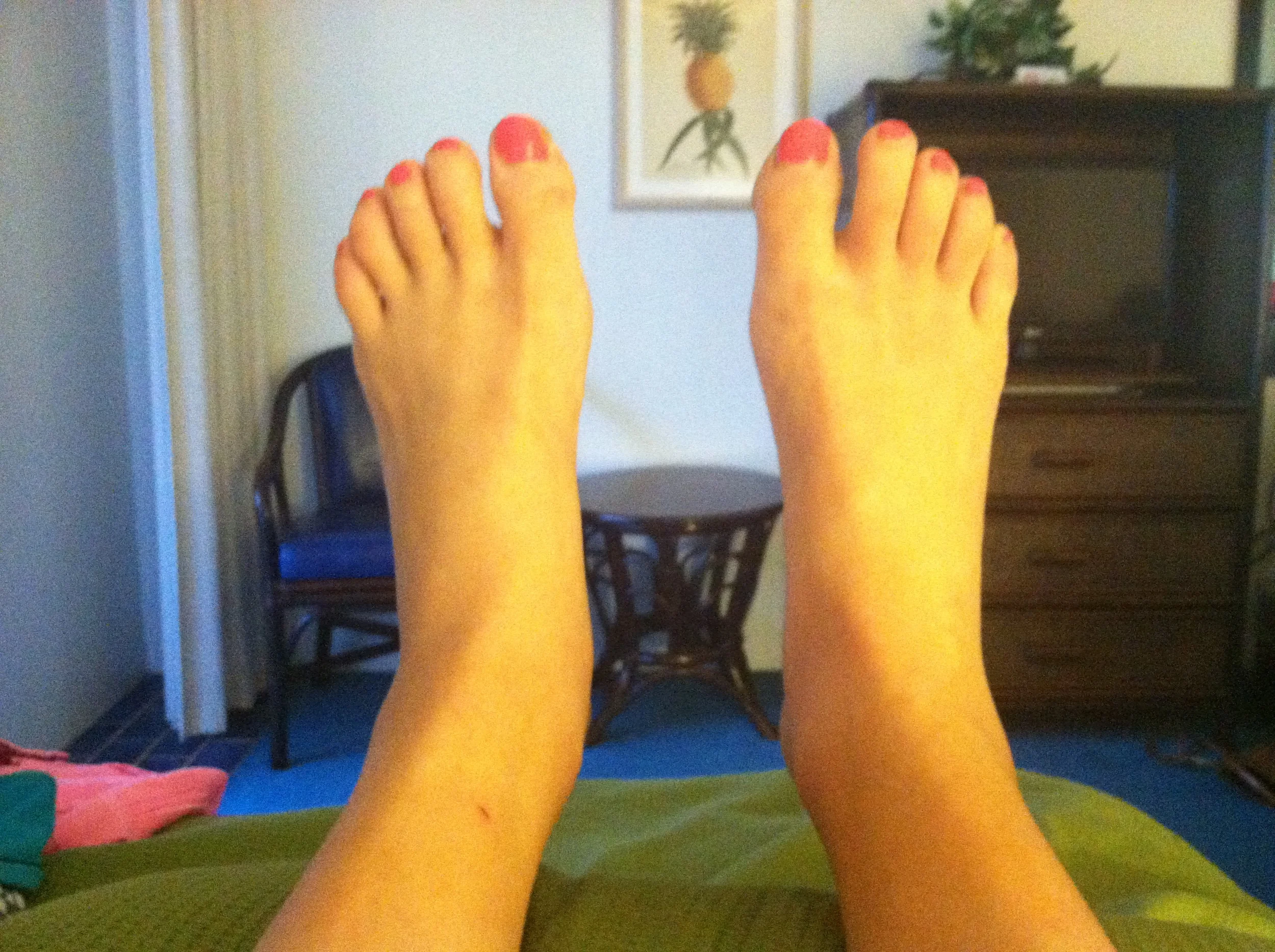 Big, swollen, sausage feet. 