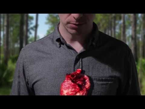 Spot 72 Heart