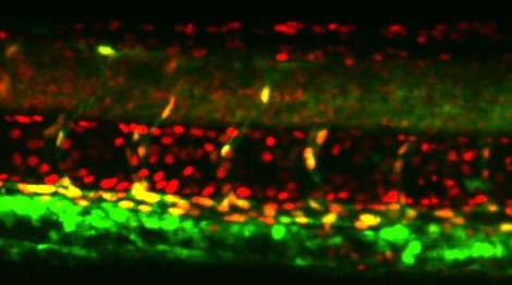 TP1::nls-mCherry (active Notch signaling); ETV2-BAC::eyfp (endothelium) 36 hpf zebrafish embryo. Image courtesy of the Wythe lab.