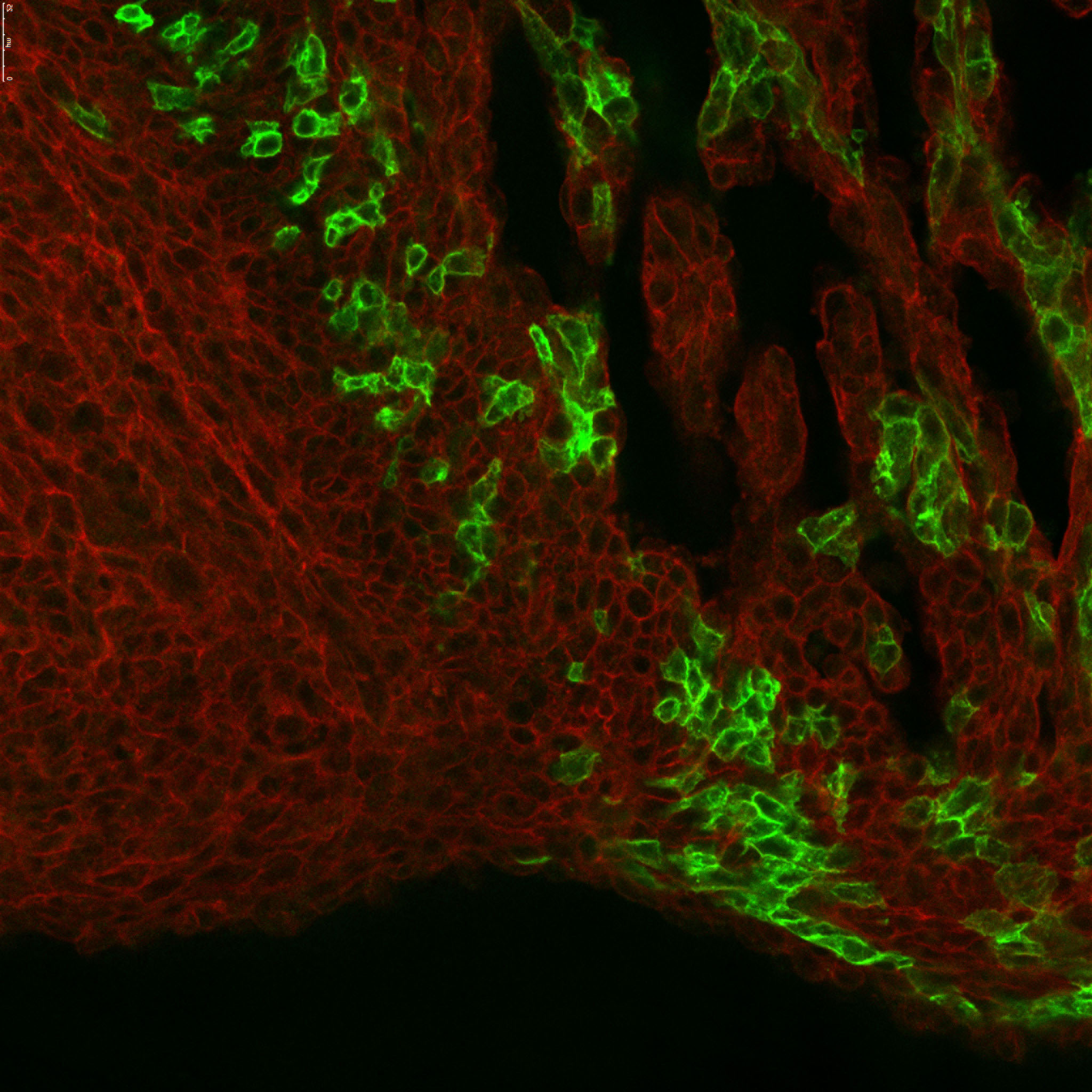 A confocal stack of the septum of an E14.5 Tbx5-CreER/+; R26-mTmG/+ heart pulsed at E7.5 with tamoxifen.