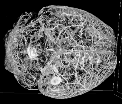  micro-CT image of an adult mouse brain following vascular perfusion of a contrast agent. Imaged at the OVIM core at BCM. 