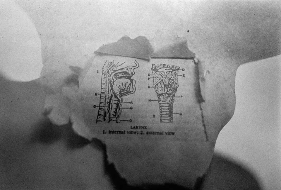  Larynx  silver gelatin print, 1997 