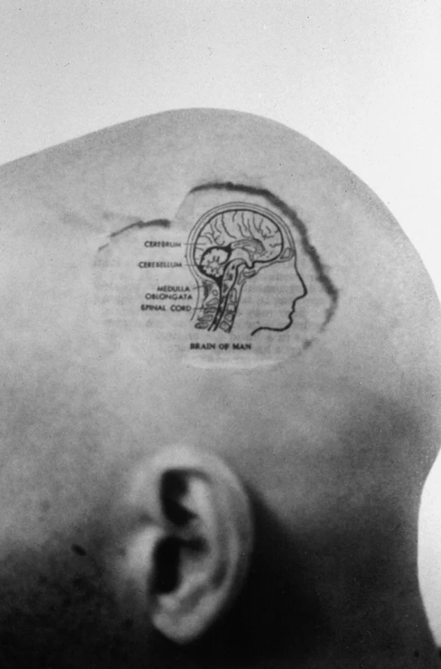  Brain  silver gelatin print, 1997 