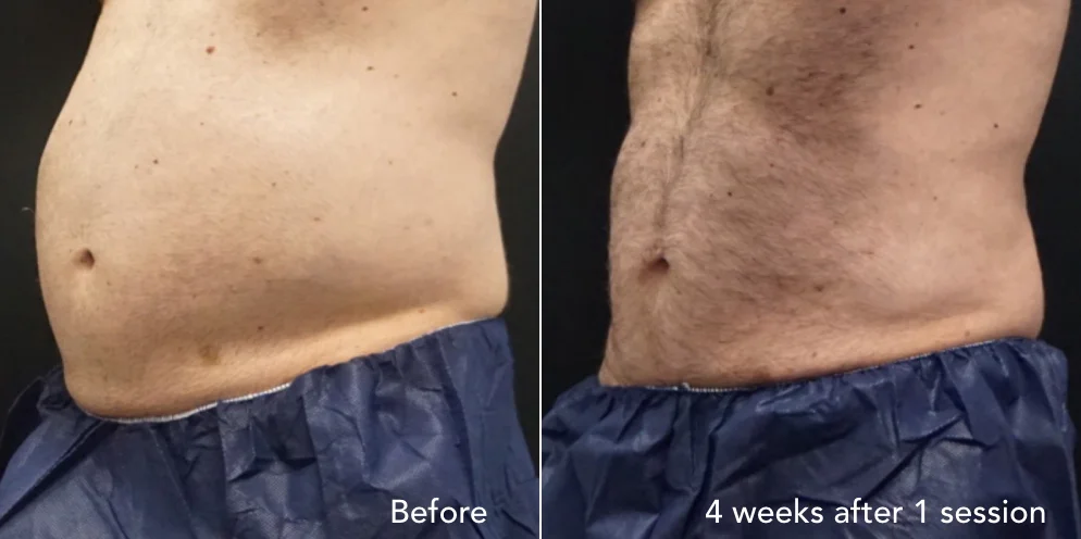 CS before & after - updated 3.015.jpeg