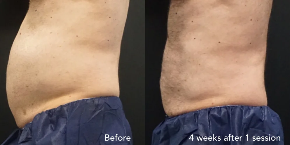 CS before & after - updated 3.016.jpeg