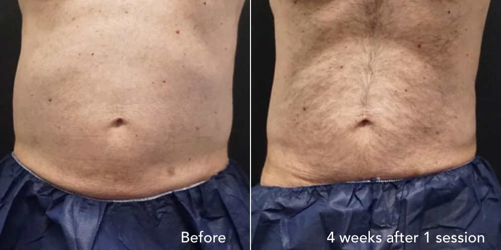 CS before & after - updated 3.014.jpeg