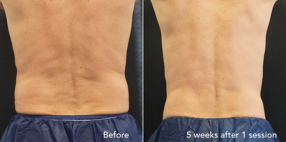 CS before & after - updated 3.013.jpeg