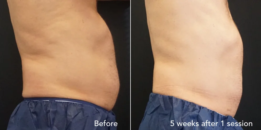 CS before & after - updated 3.012.jpeg