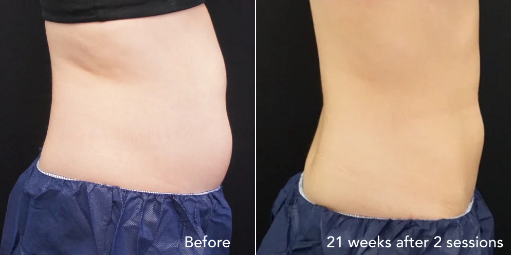 CS before & after - updated 3.010.jpeg