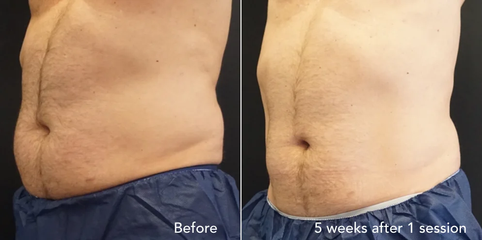 CS before & after - updated 3.011.jpeg