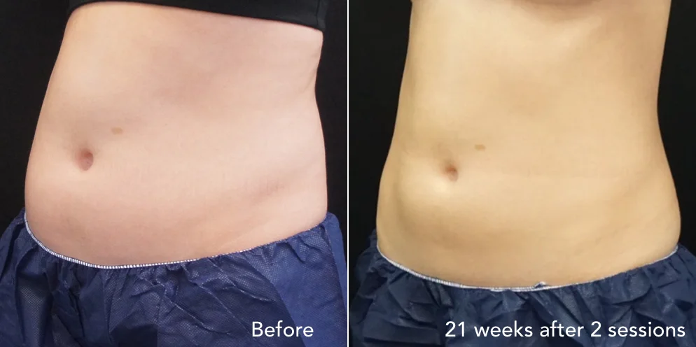 CS before & after - updated 3.009.jpeg