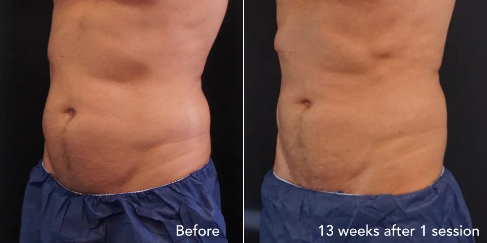 CS before & after - updated 3.007.jpeg