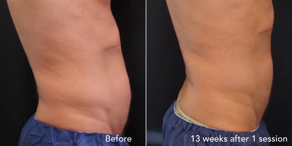 CS before & after - updated 3.008.jpeg