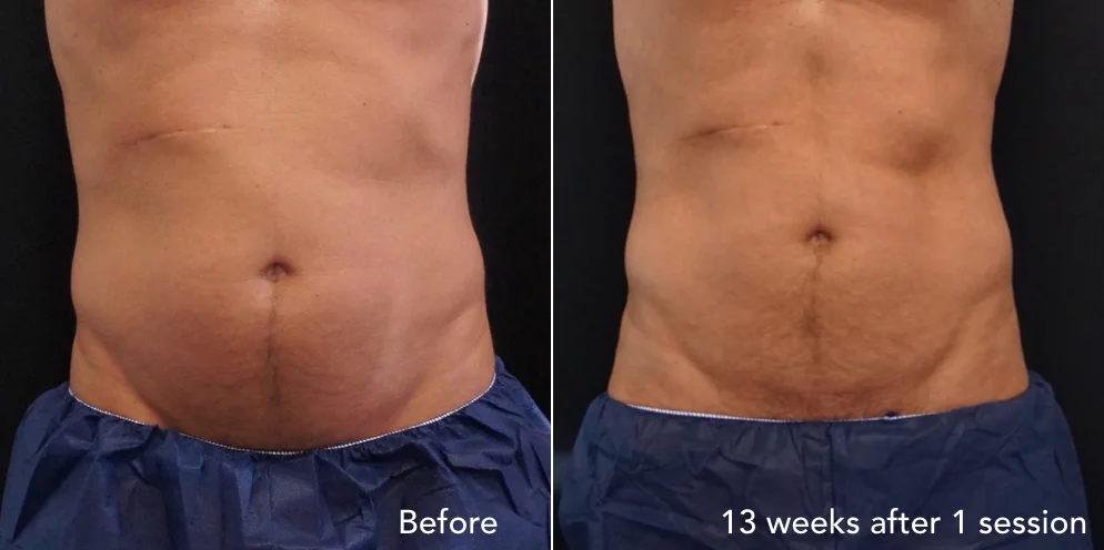 CS before & after - updated 3.006.jpeg