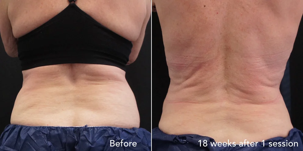 CS before & after - updated 3.005.jpeg