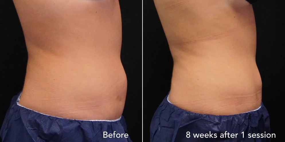 CS before & after - updated 3.004.jpeg