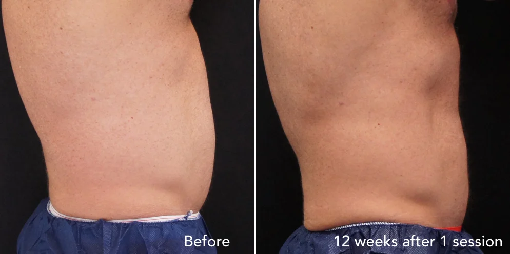 CS before & after - updated 3.003.jpeg