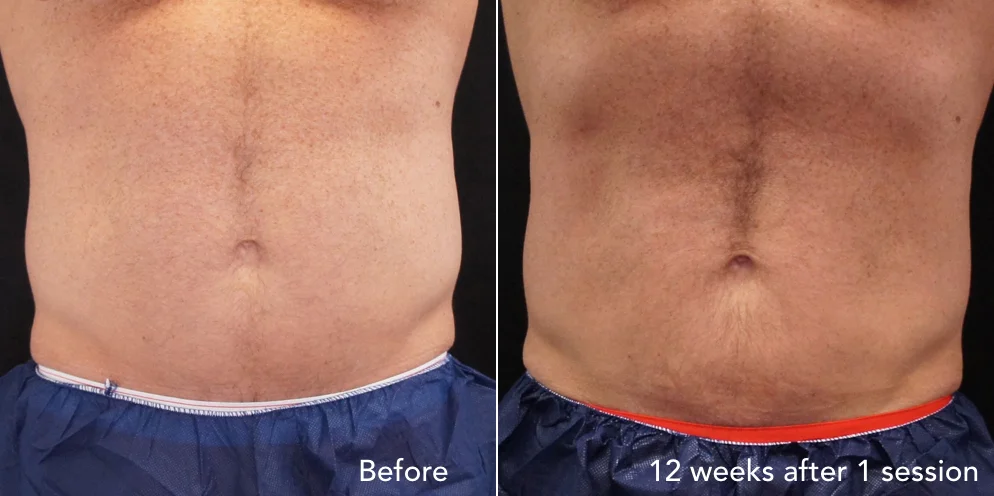 CS before & after - updated 3.001.jpeg