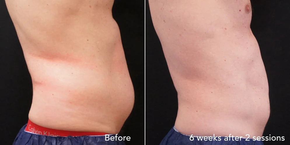 CS before & after - updated 3.018.jpeg