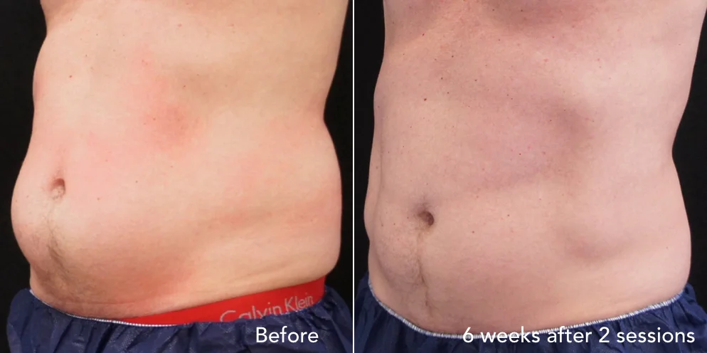 CS before & after - updated 3.020.jpeg