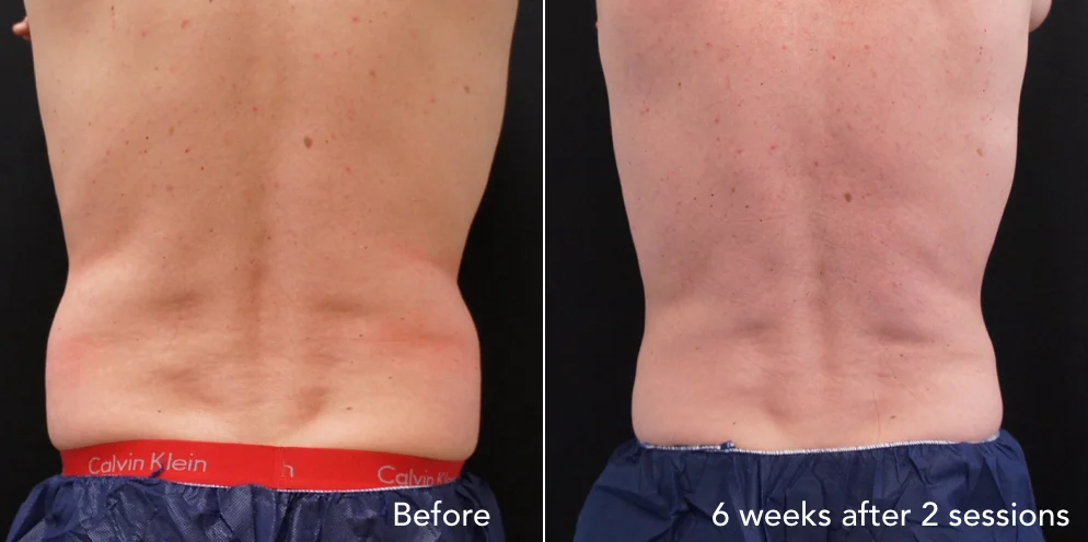 CS before & after - updated 3.019.jpeg