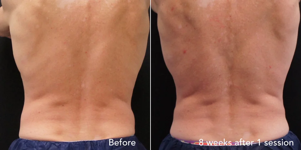 CS before & after - updated new 1.007.jpeg