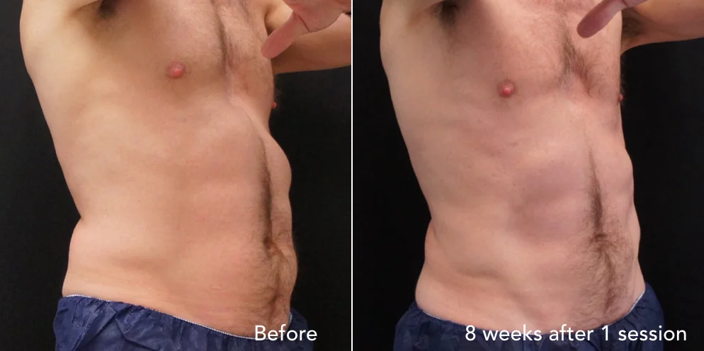 CS before & after - updated new 1.006.jpeg