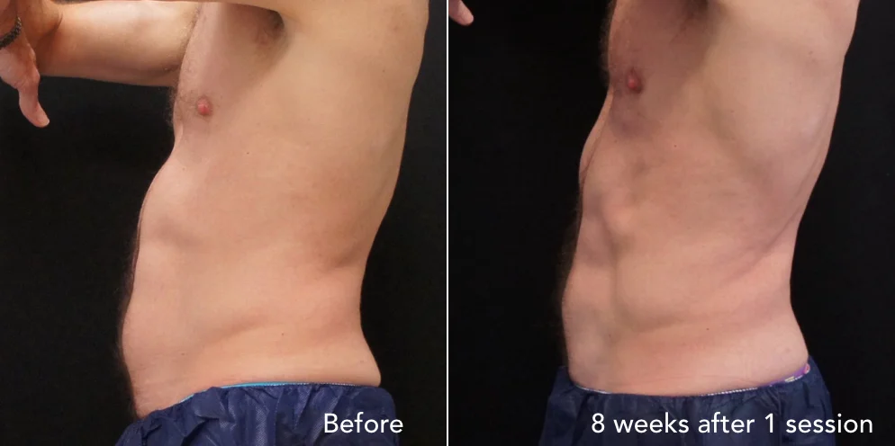 CS before & after - updated new 1.005.jpeg