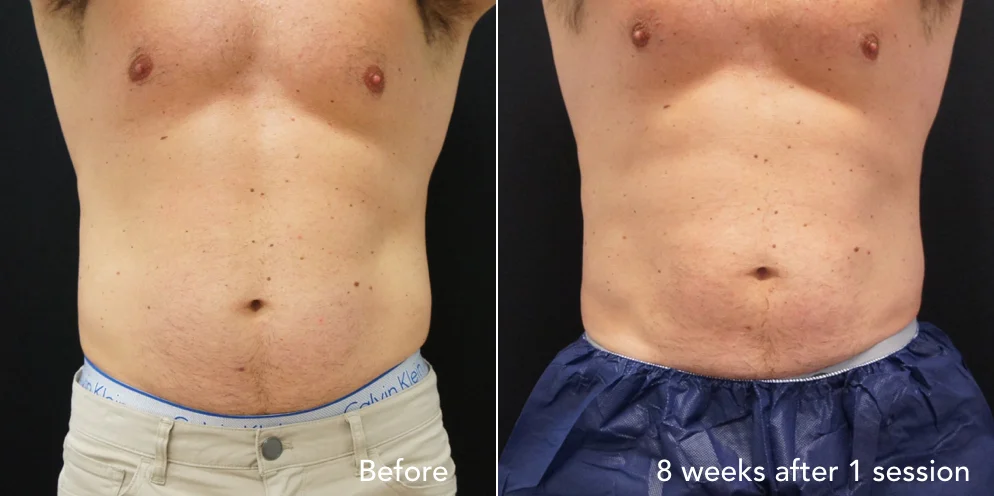 CS before & after - updated new 1.004.jpeg