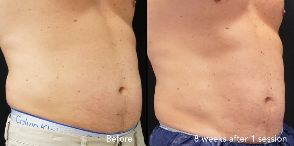 CS before & after - updated new 1.003.jpeg