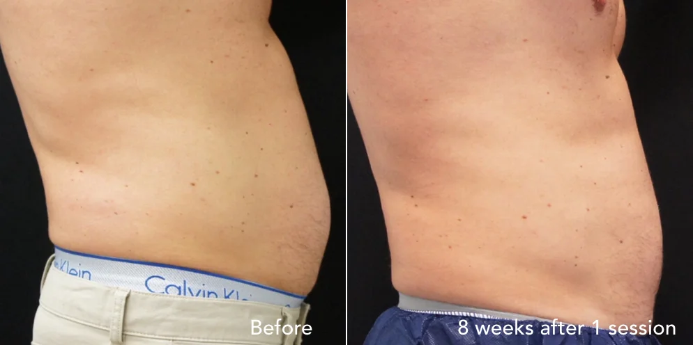 CS before & after - updated new 1.002.jpeg