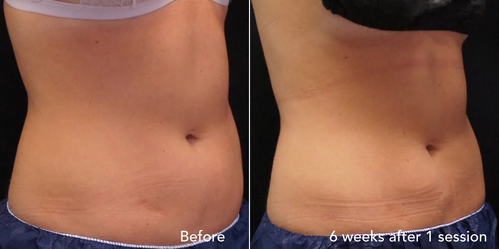 CS before & after - updated 3.030.jpeg