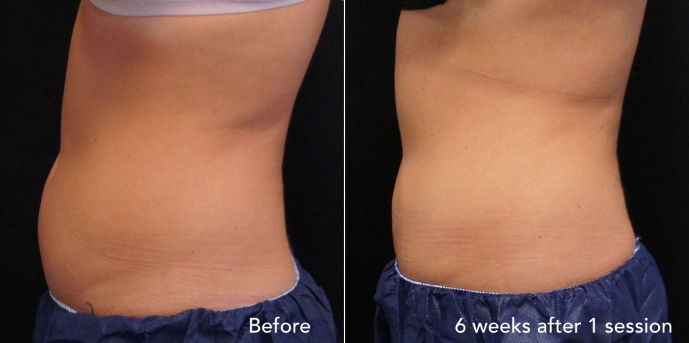 CS before & after - updated 3.031.jpeg