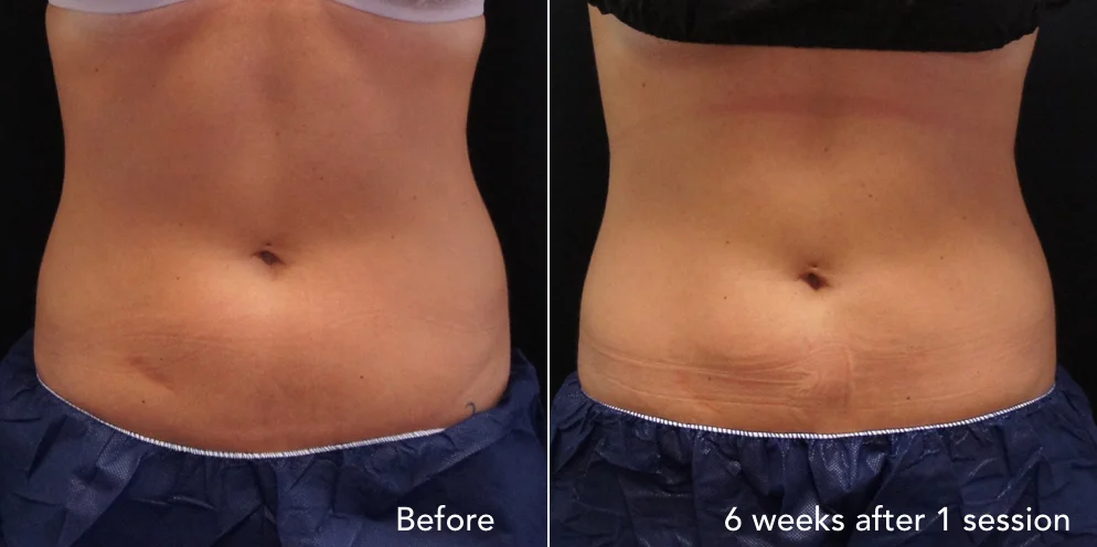 CS before & after - updated 3.029.jpeg