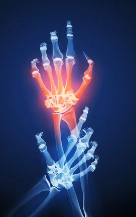 iStock_000006911928XSmall.jpg