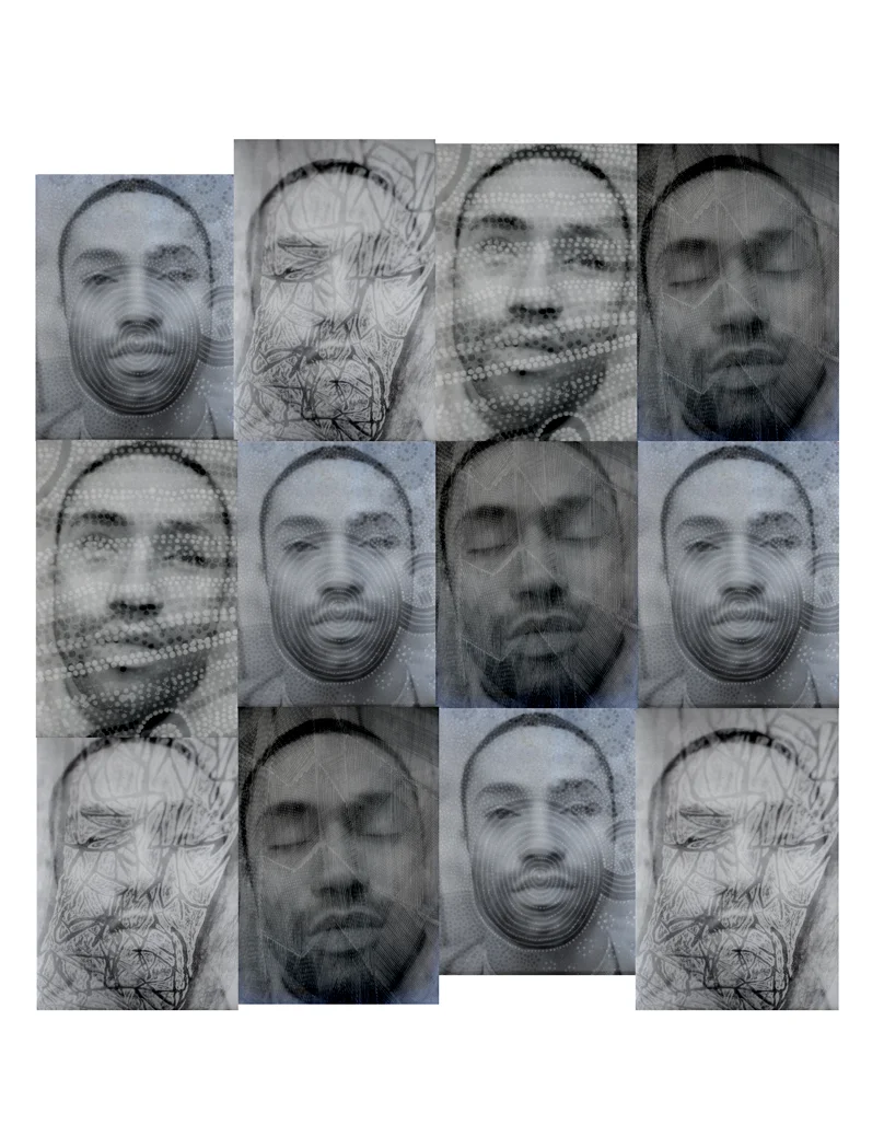 ‘Bioptim’ 1993