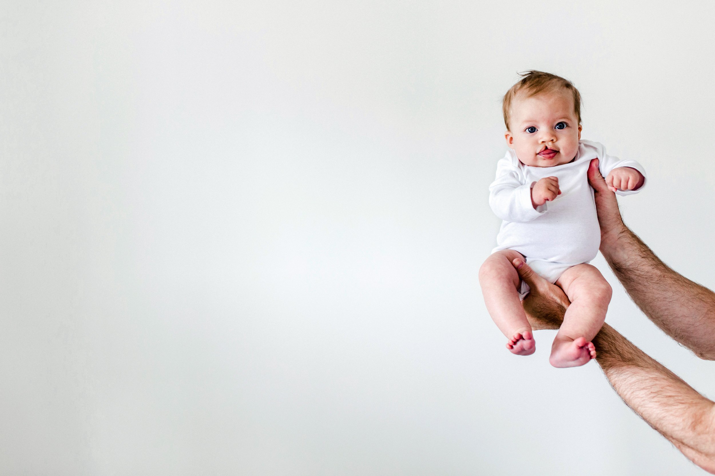 cleft lip baby calgary photography