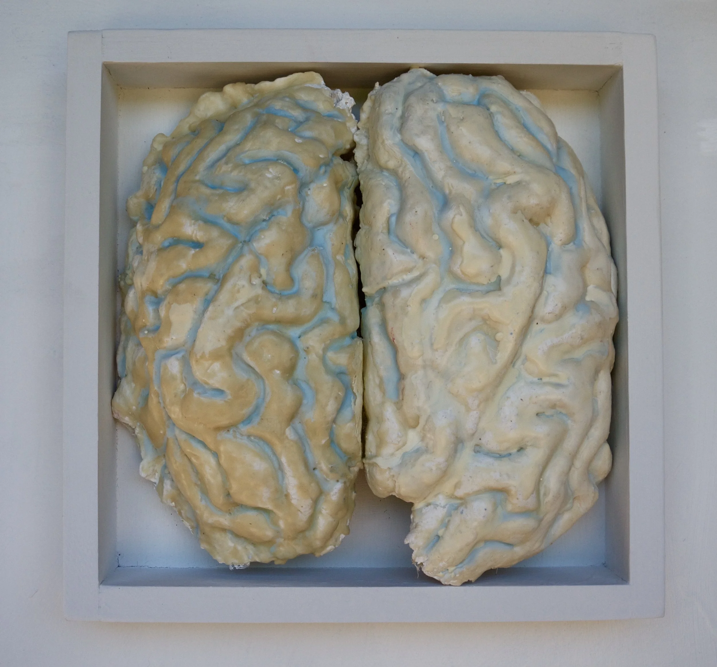Joan Harmon, Internal Organ Series #3