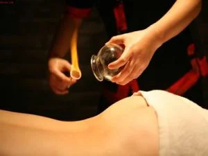 Fire-Cupping-1.jpg