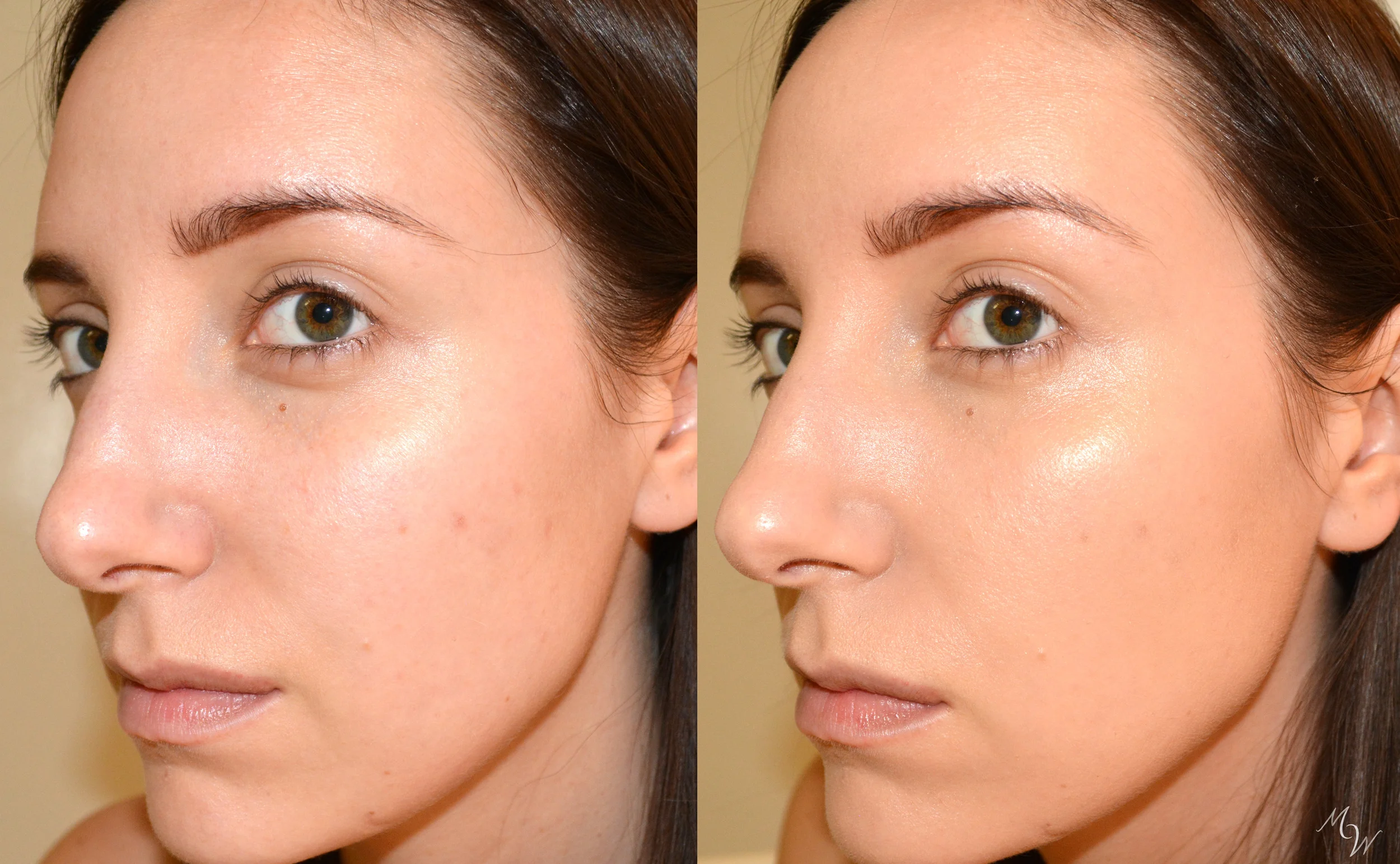 Gressa Before and After.jpg