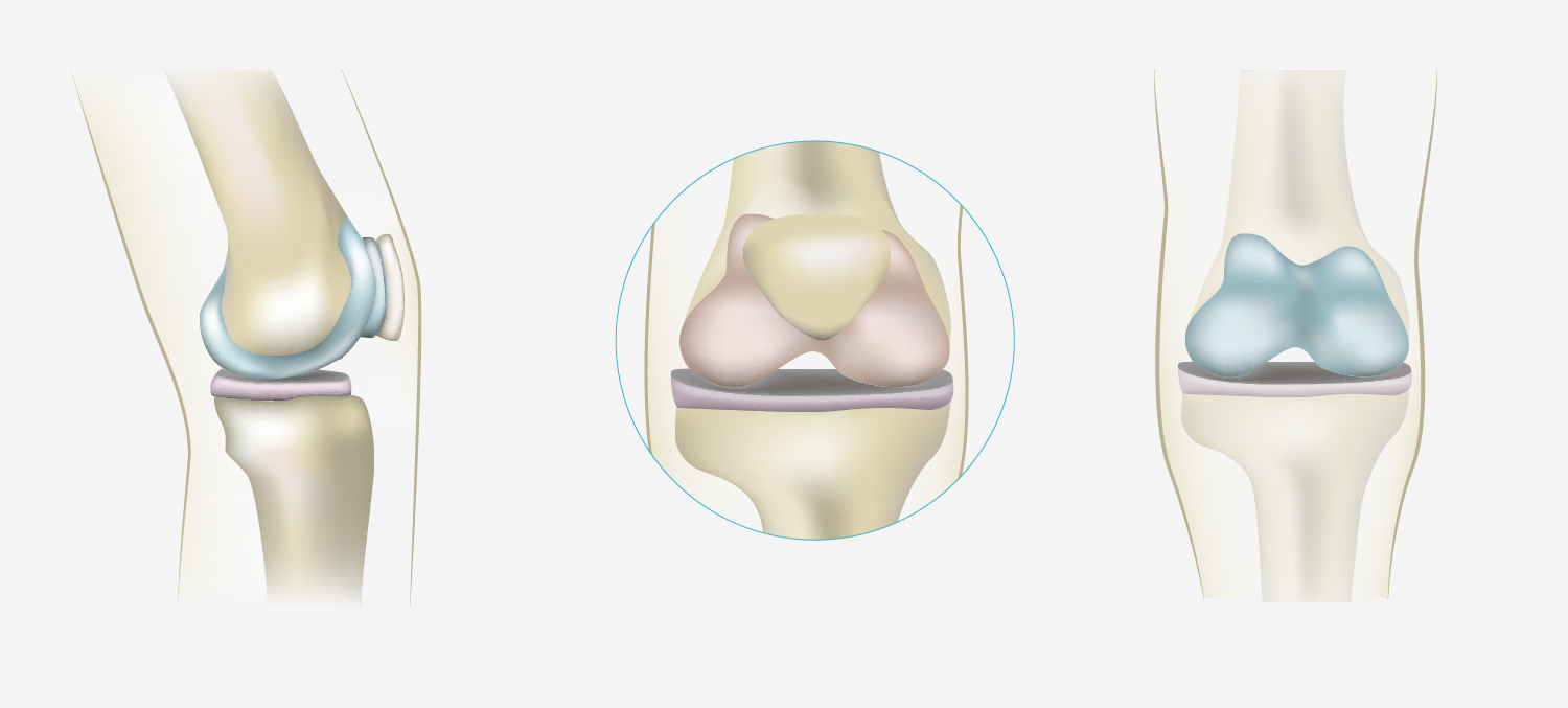 Several illustrations of the knee done for the interactive application.